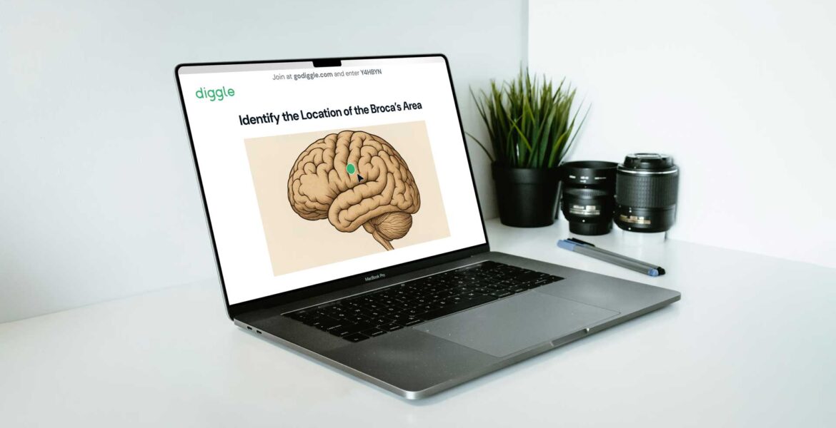 A macbook with an illustration of a brain for a test.