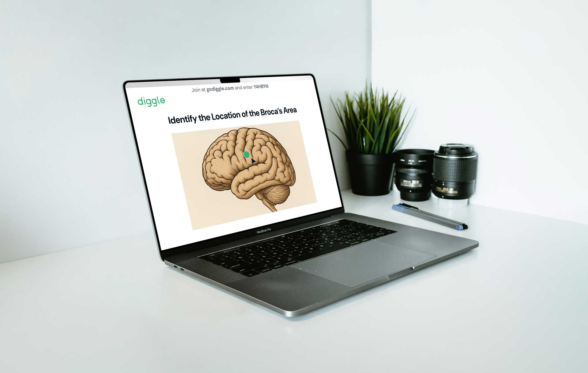 A macbook with an illustration of a brain for a test.